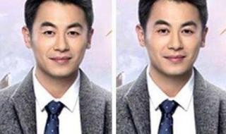 单眼皮变双眼皮图片 单眼皮变双眼皮图片